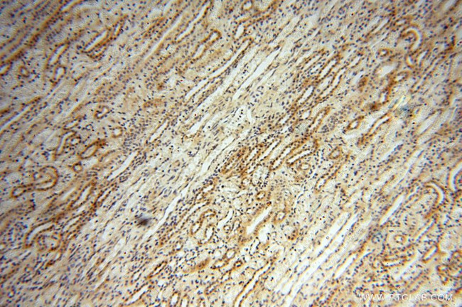 CAMSAP2 Antibody in Immunohistochemistry (Paraffin) (IHC (P))