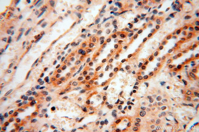 CAMSAP2 Antibody in Immunohistochemistry (Paraffin) (IHC (P))