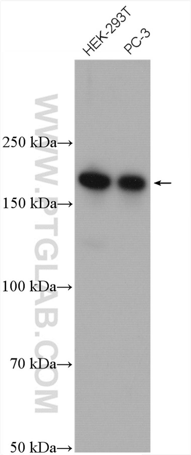 CAMSAP2 Antibody in Western Blot (WB)