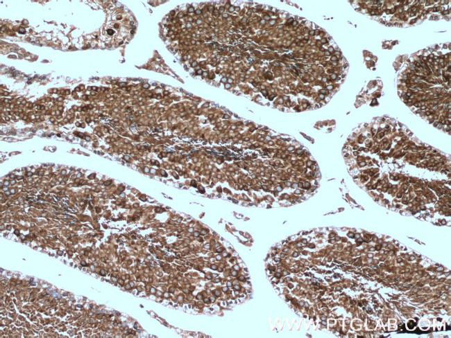 CAMSAP2 Antibody in Immunohistochemistry (Paraffin) (IHC (P))