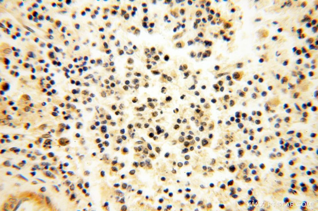 CAMSAP2 Antibody in Immunohistochemistry (Paraffin) (IHC (P))