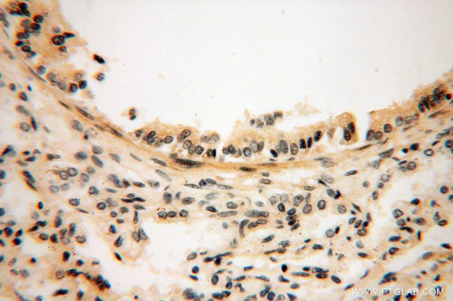 CAMSAP2 Antibody in Immunohistochemistry (Paraffin) (IHC (P))