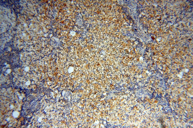 CAMSAP2 Antibody in Immunohistochemistry (Paraffin) (IHC (P))