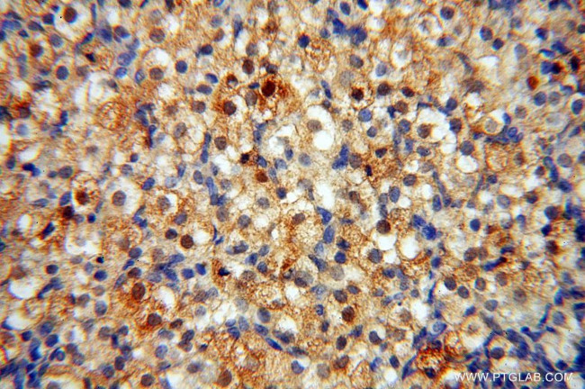 CAMSAP2 Antibody in Immunohistochemistry (Paraffin) (IHC (P))