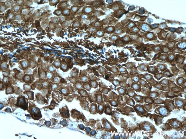 CAMSAP2 Antibody in Immunohistochemistry (Paraffin) (IHC (P))