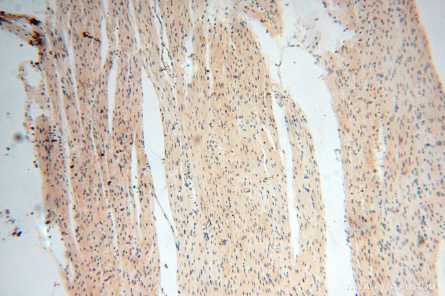 CAMSAP2 Antibody in Immunohistochemistry (Paraffin) (IHC (P))