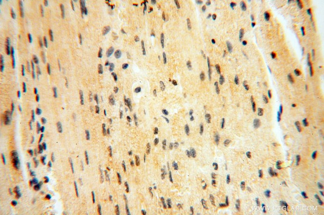 CAMSAP2 Antibody in Immunohistochemistry (Paraffin) (IHC (P))