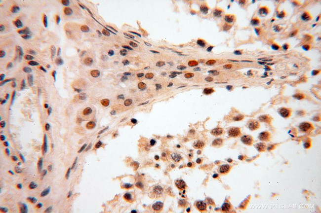 CAMSAP2 Antibody in Immunohistochemistry (Paraffin) (IHC (P))