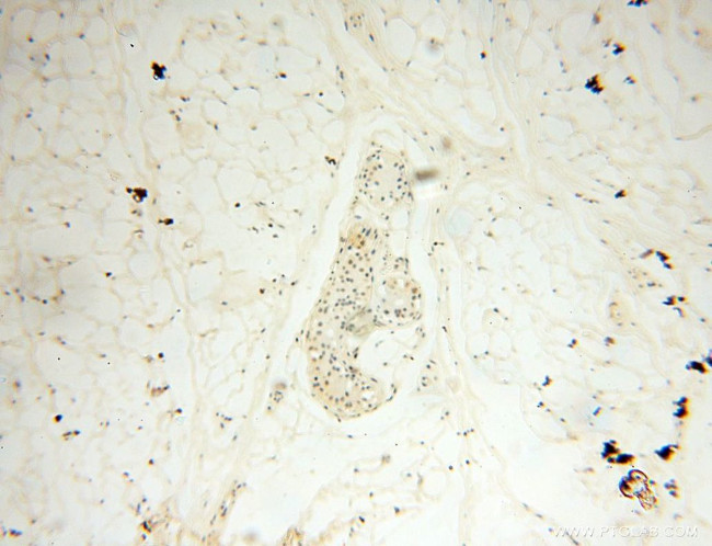 CAMSAP2 Antibody in Immunohistochemistry (Paraffin) (IHC (P))