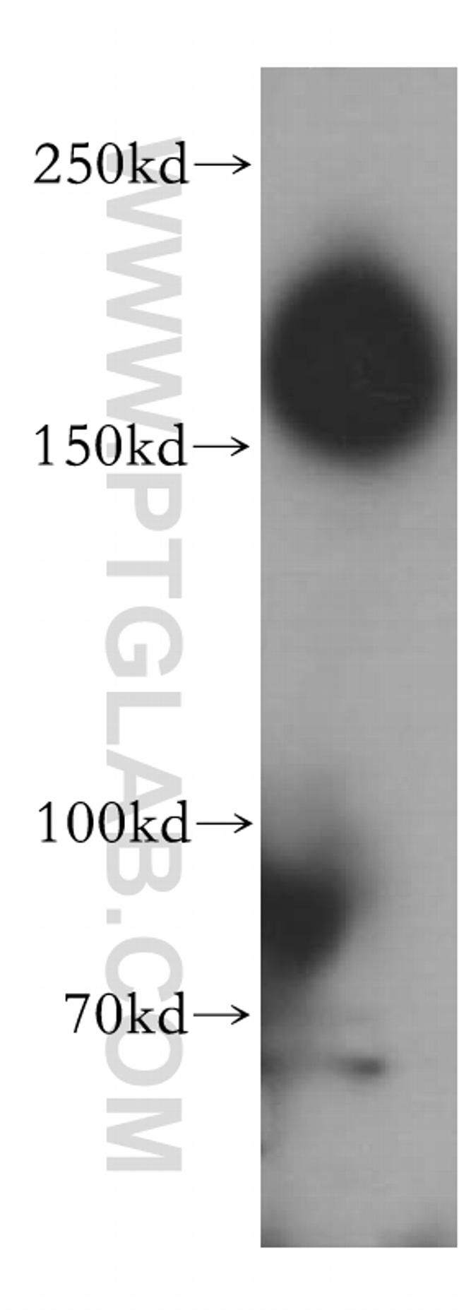 CAMSAP2 Antibody in Western Blot (WB)