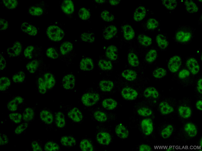 THOC7 Antibody in Immunocytochemistry (ICC/IF)