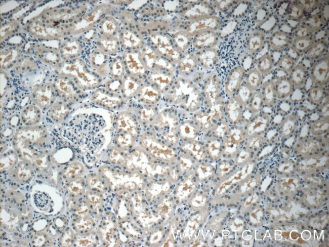 THOC7 Antibody in Immunohistochemistry (Paraffin) (IHC (P))