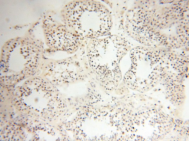 THOC7 Antibody in Immunohistochemistry (Paraffin) (IHC (P))