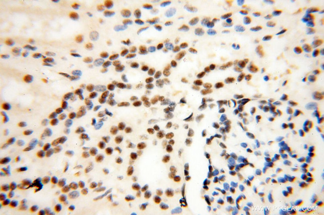 THOC7 Antibody in Immunohistochemistry (Paraffin) (IHC (P))