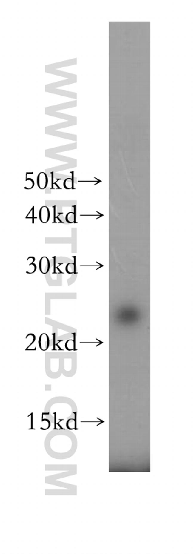 THOC7 Antibody in Western Blot (WB)