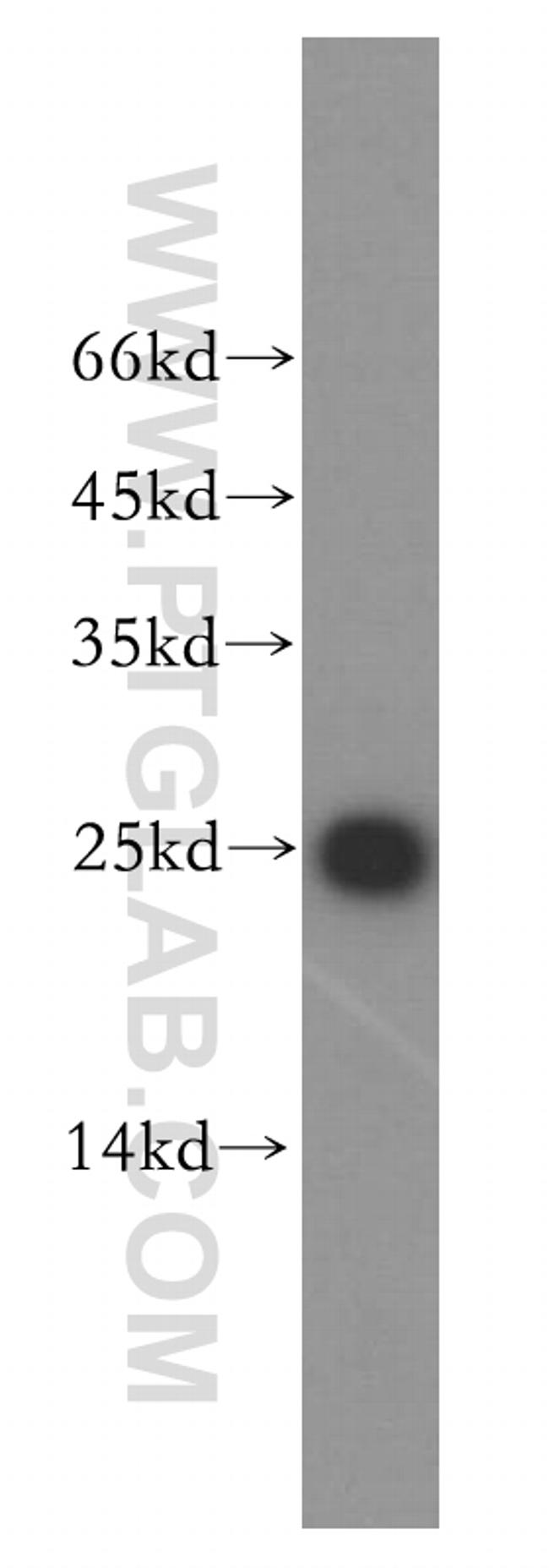 THOC7 Antibody in Western Blot (WB)