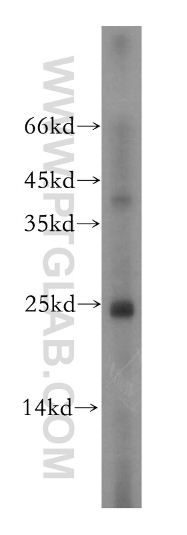 THOC7 Antibody in Western Blot (WB)