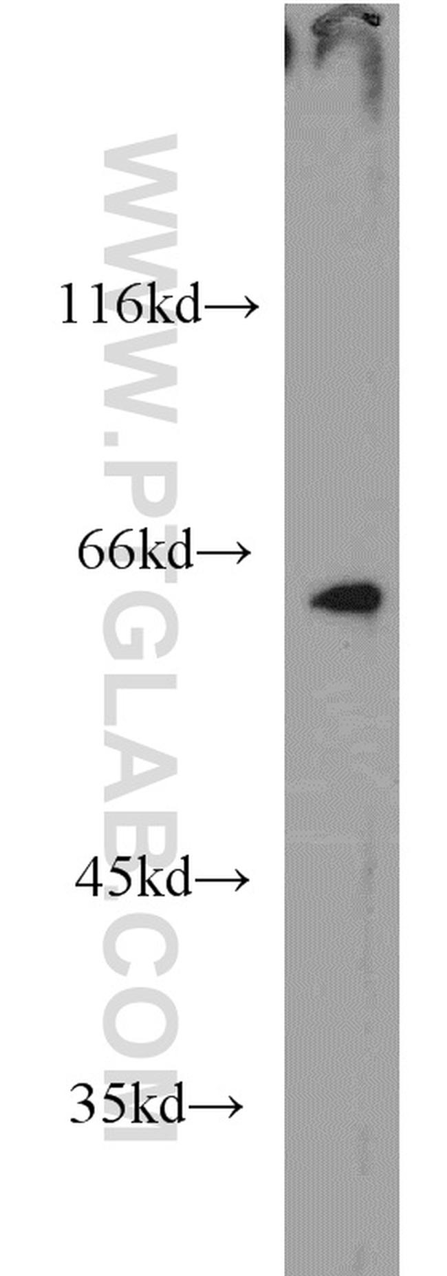 LIN9 Antibody in Western Blot (WB)