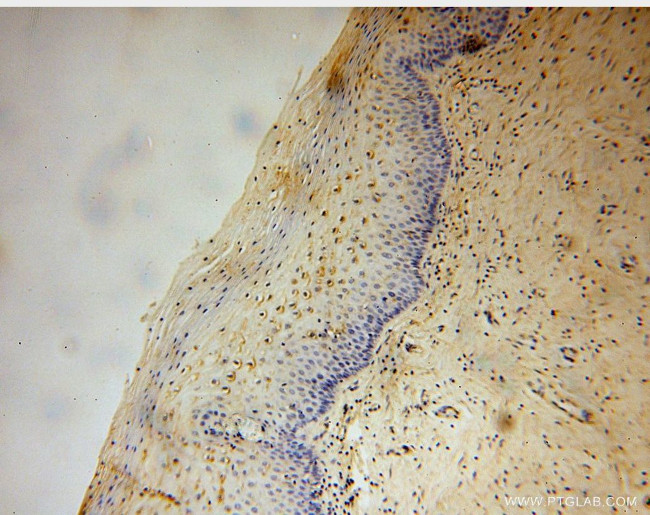 DGKQ Antibody in Immunohistochemistry (Paraffin) (IHC (P))