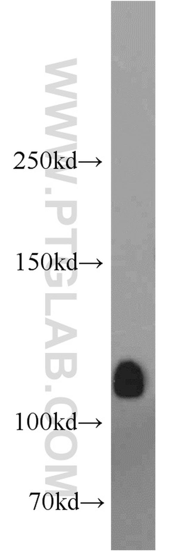 DGKQ Antibody in Western Blot (WB)