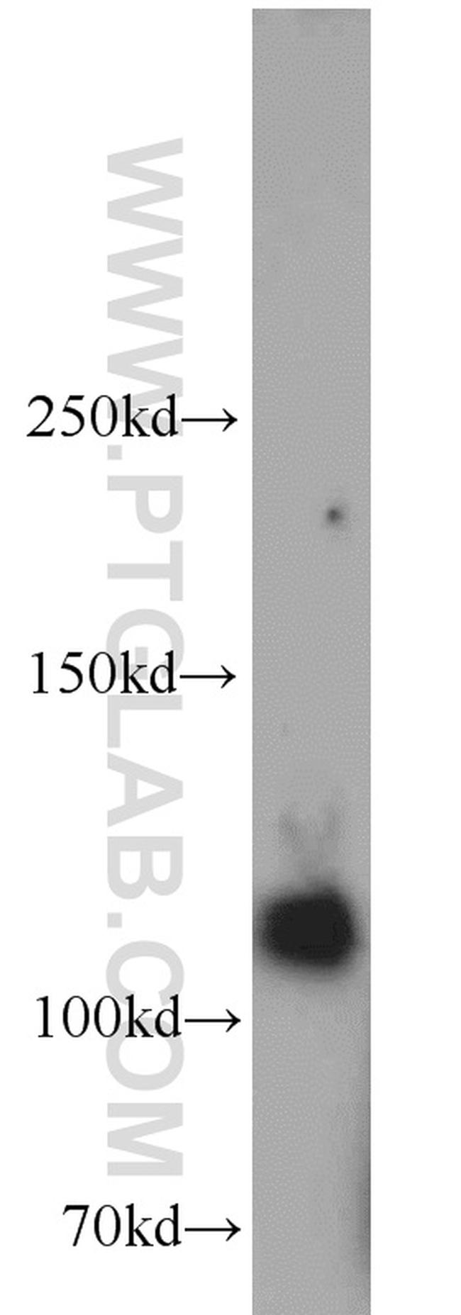 DGKQ Antibody in Western Blot (WB)