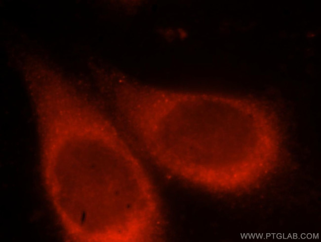 VPS15 Antibody in Immunocytochemistry (ICC/IF)