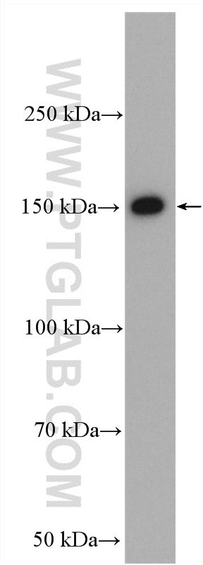 VPS15 Antibody in Western Blot (WB)