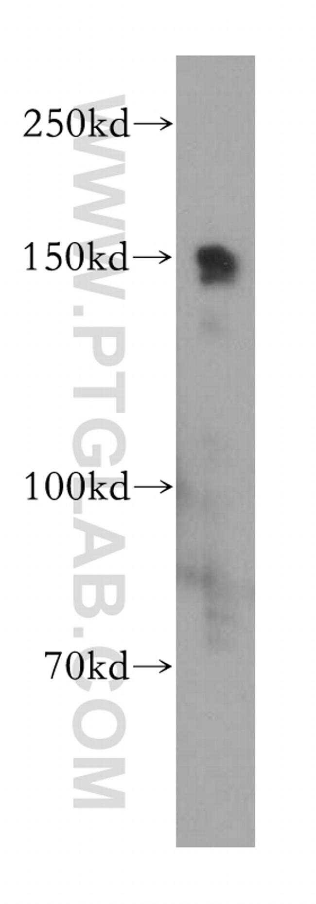 VPS15 Antibody in Western Blot (WB)