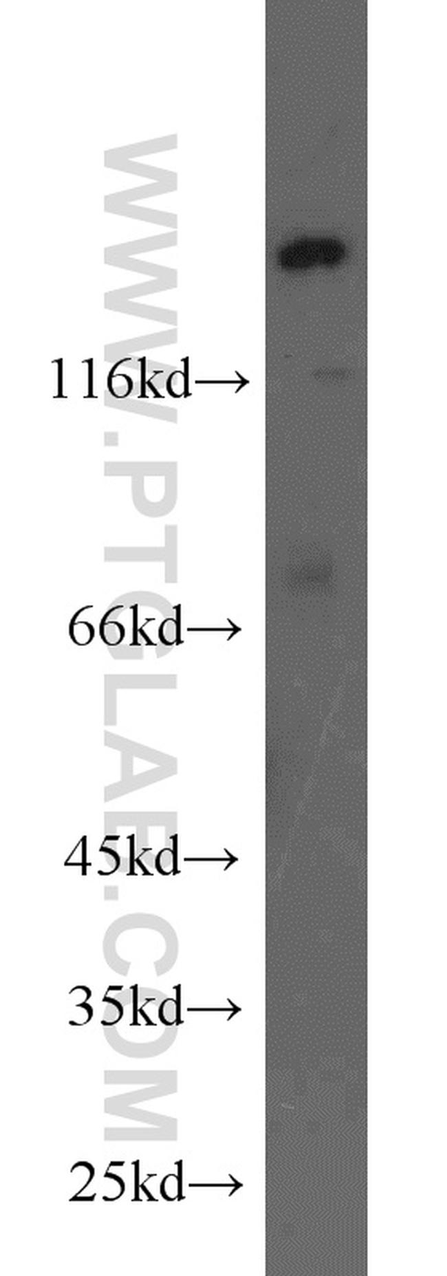 VPS15 Antibody in Western Blot (WB)