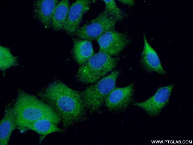 ADAMDEC1 Antibody in Immunocytochemistry (ICC/IF)