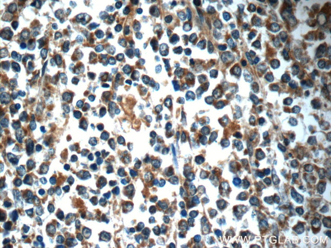 ADAMDEC1 Antibody in Immunohistochemistry (Paraffin) (IHC (P))