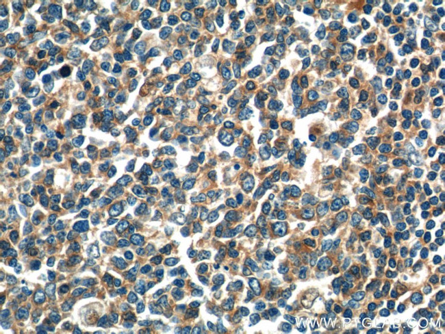 ADAMDEC1 Antibody in Immunohistochemistry (Paraffin) (IHC (P))