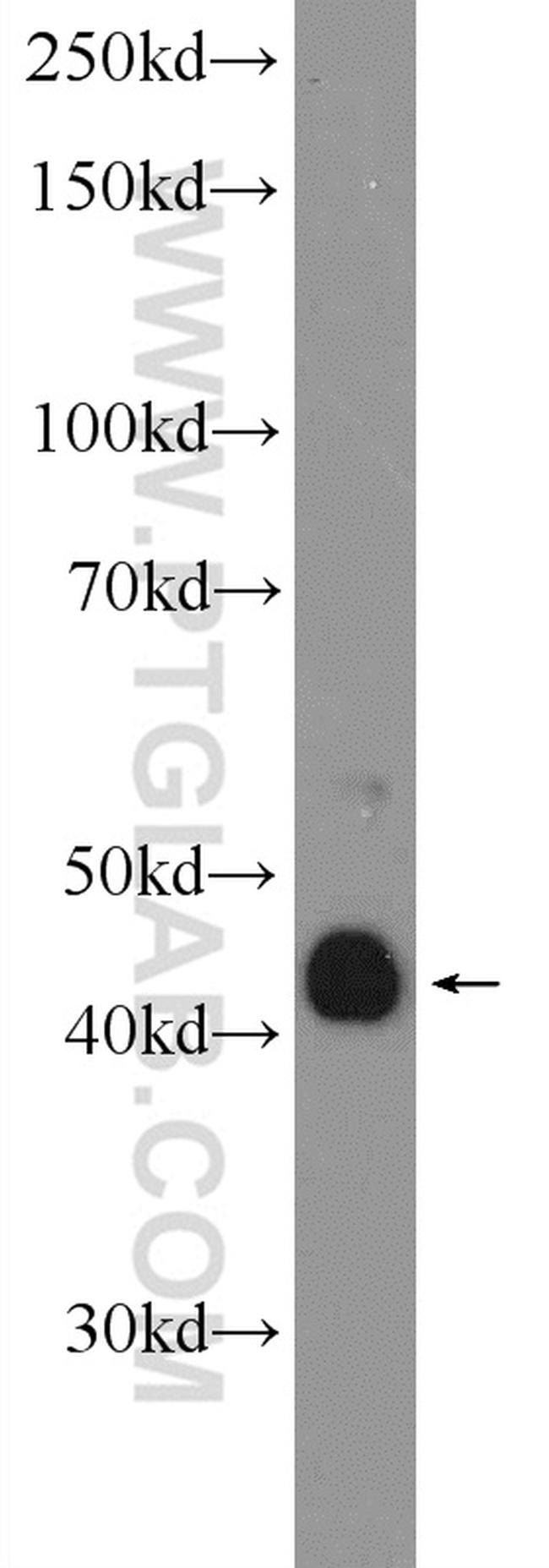 ADAMDEC1 Antibody in Western Blot (WB)