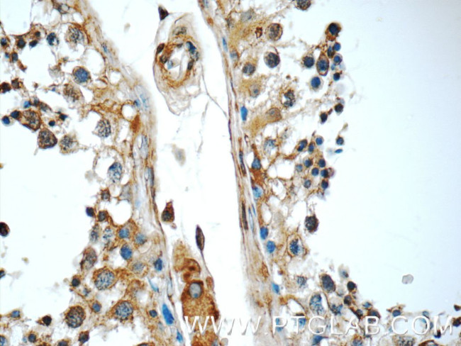 GAS1 Antibody in Immunohistochemistry (Paraffin) (IHC (P))