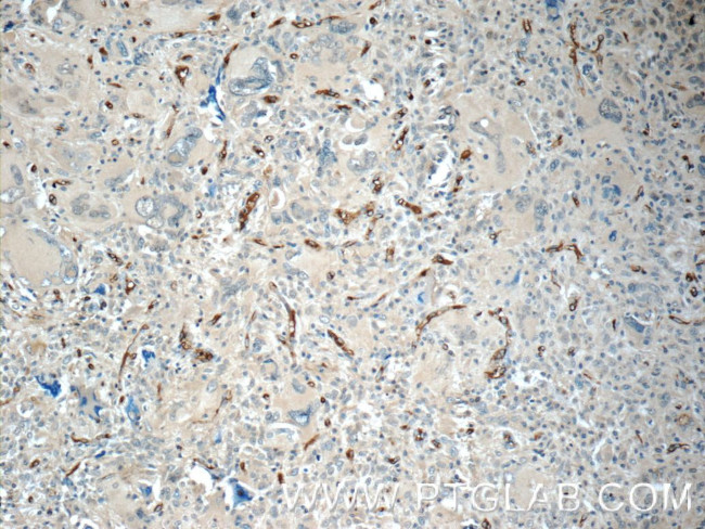 GAS1 Antibody in Immunohistochemistry (Paraffin) (IHC (P))