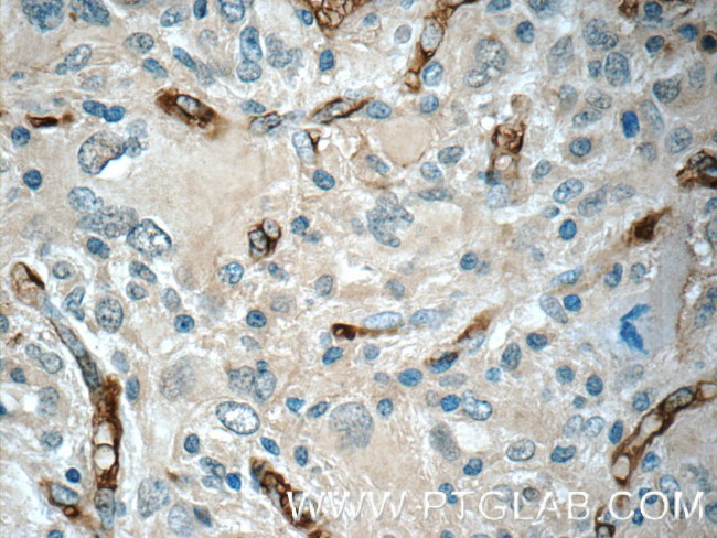 GAS1 Antibody in Immunohistochemistry (Paraffin) (IHC (P))