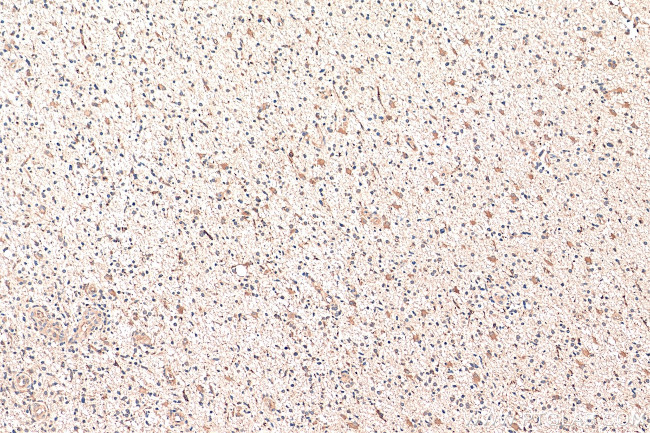 GAS1 Antibody in Immunohistochemistry (Paraffin) (IHC (P))