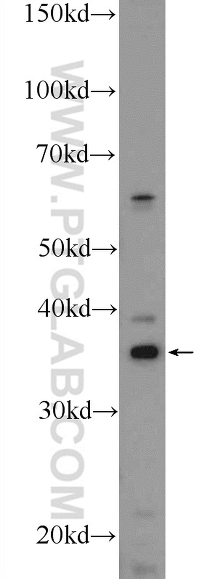 GAS1 Antibody in Western Blot (WB)