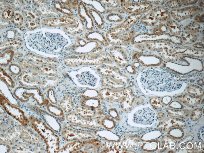 EPO Antibody in Immunohistochemistry (Paraffin) (IHC (P))