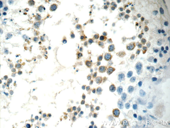 FAAH Antibody in Immunohistochemistry (Paraffin) (IHC (P))