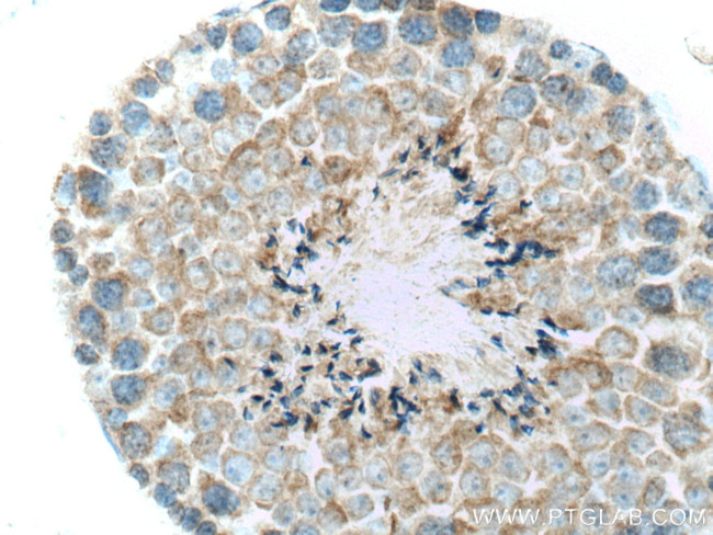 FAAH Antibody in Immunohistochemistry (Paraffin) (IHC (P))