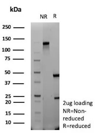 TdT/DNA Nucleotidylexotransferase Antibody in SDS-PAGE (SDS-PAGE)