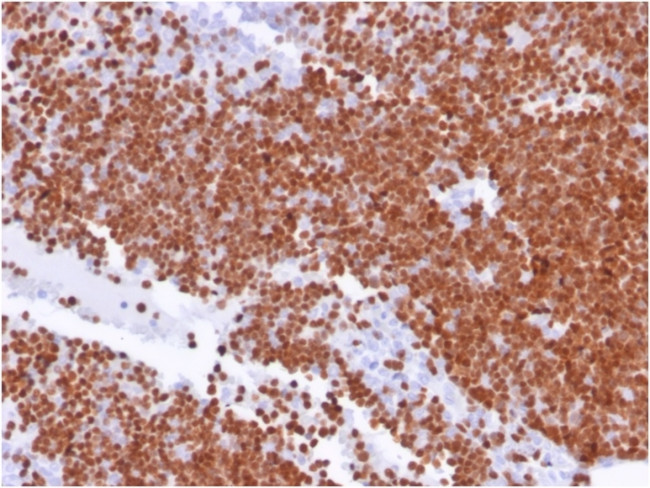 TdT/DNA Nucleotidylexotransferase Antibody in Immunohistochemistry (Paraffin) (IHC (P))