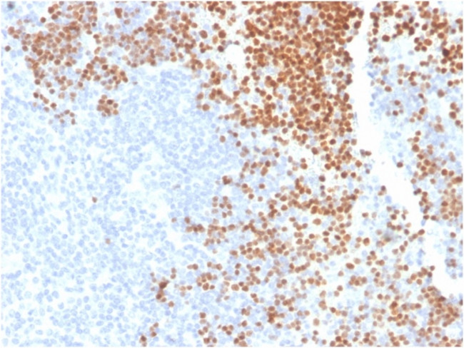 TdT/DNA Nucleotidylexotransferase (Acute Lymphoblastic Leukemia Marker) Antibody in Immunohistochemistry (Paraffin) (IHC (P))