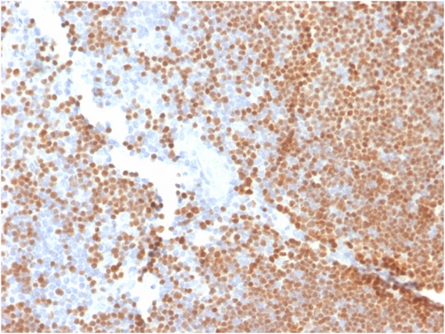 TdT/DNA Nucleotidylexotransferase (Acute Lymphoblastic Leukemia Marker) Antibody in Immunohistochemistry (Paraffin) (IHC (P))