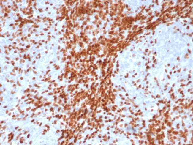 TdT/DNA Nucleotidylexotransferase (Acute Lymphoblastic Leukemia Marker) Antibody in Immunohistochemistry (Paraffin) (IHC (P))