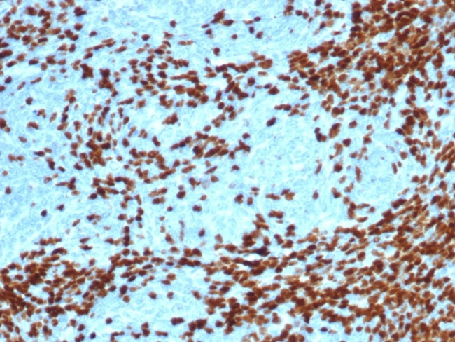 TdT/DNA Nucleotidylexotransferase (Acute Lymphoblastic Leukemia Marker) Antibody in Immunohistochemistry (Paraffin) (IHC (P))