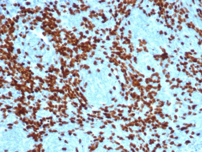 TdT/DNA Nucleotidylexotransferase (Acute Lymphoblastic Leukemia Marker) Antibody in Immunohistochemistry (Paraffin) (IHC (P))
