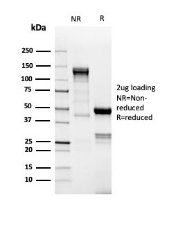 TdT/DNA Nucleotidylexotransferase (Acute Lymphoblastic Leukemia Marker) Antibody in SDS-PAGE (SDS-PAGE)