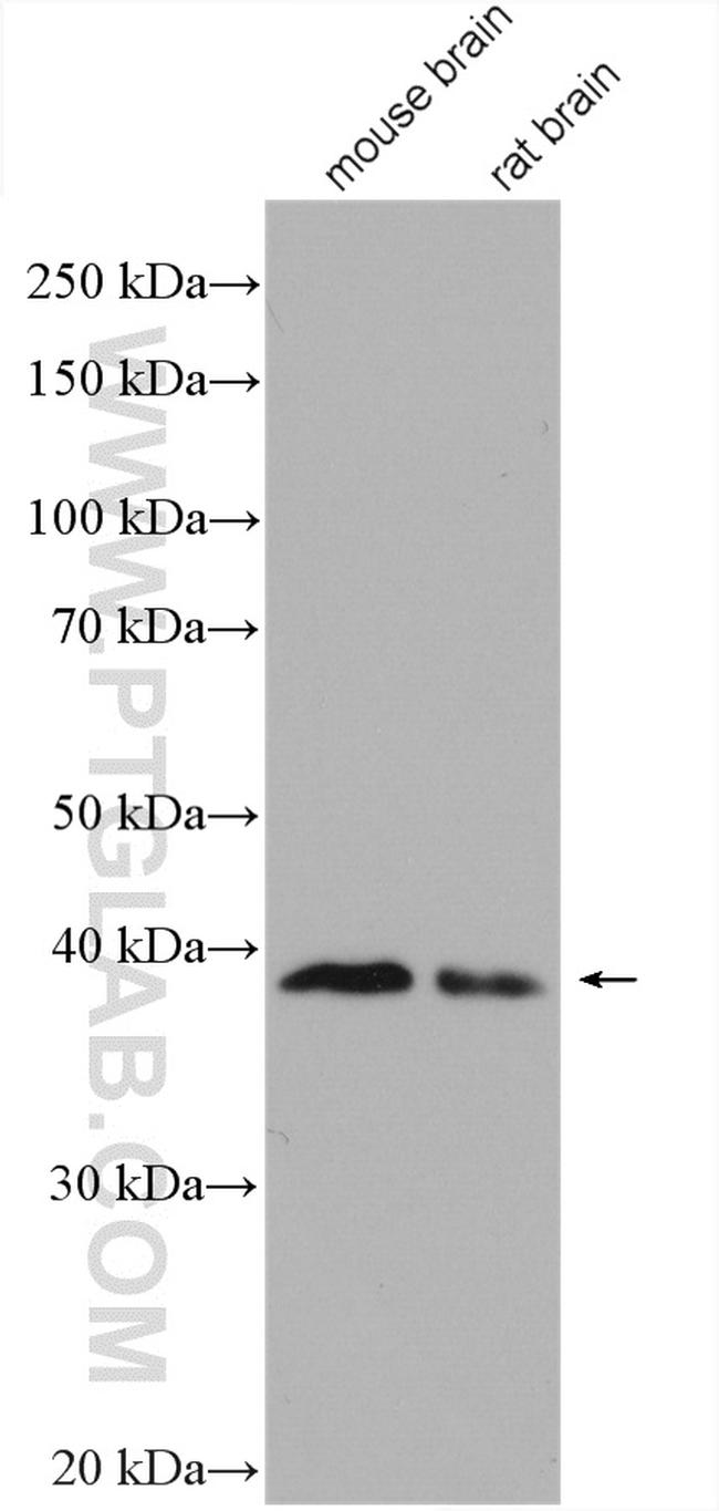 ADPRH Antibody in Western Blot (WB)
